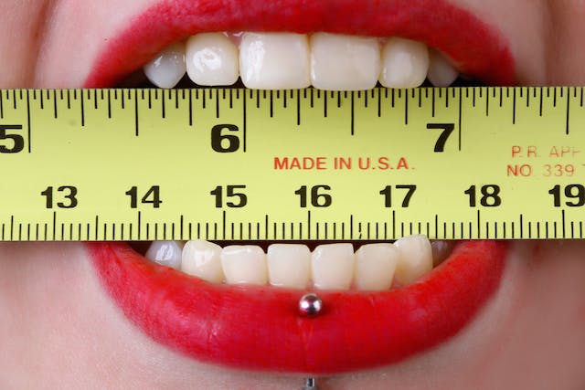 Mengapa Penting Periksa Gigi Secara Rutin? Cari Tahu di Bawah Ini!
